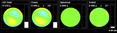 Combined HOA for Laserfit Lens with ordinary optics