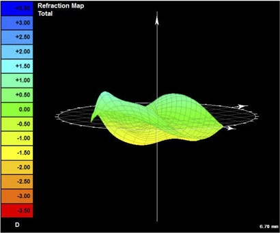 with ordinary optics looks worse than unaided eye