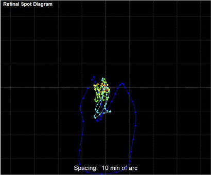 Retinal Spot Diagram Loosely clustered RSD indicates poor visual quality