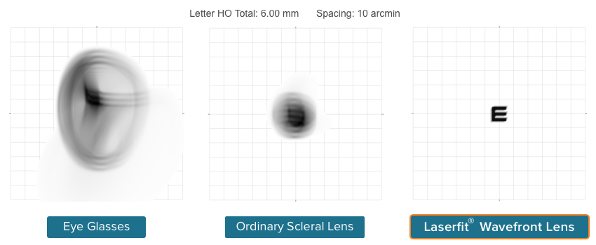 Chart showing High Order Visual Aberrations Compared