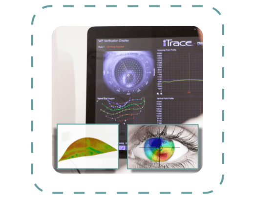 CAD modelling of custom scleral contact lens design including lens optics to counter aberrations