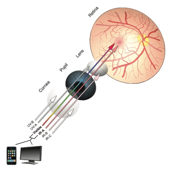 Visable Wavelength Retina Risk